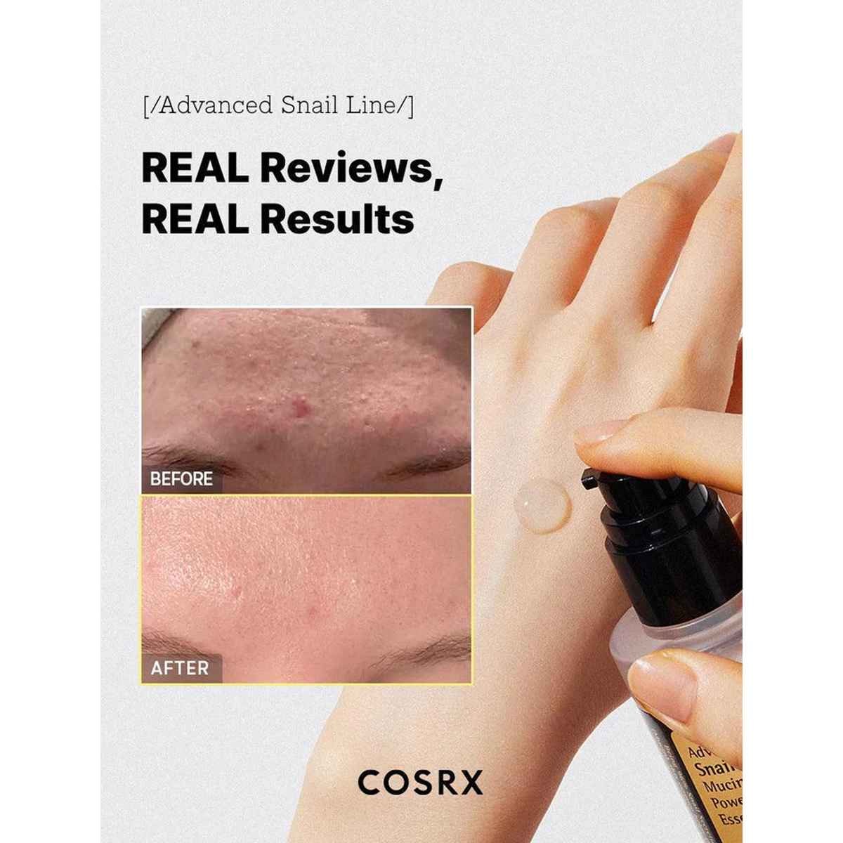 Advanced Snail 96 Mucin Power Essence - Real Reviews, Real Results