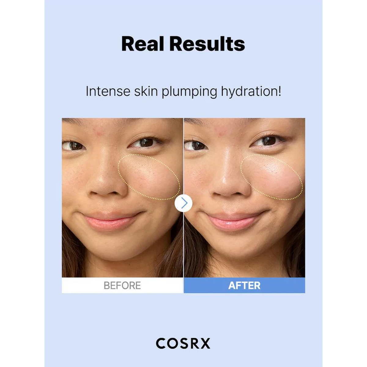 COSRX The Hyaluronic Acid 3 Serum - Real Results Intense skin plumping hydration!
