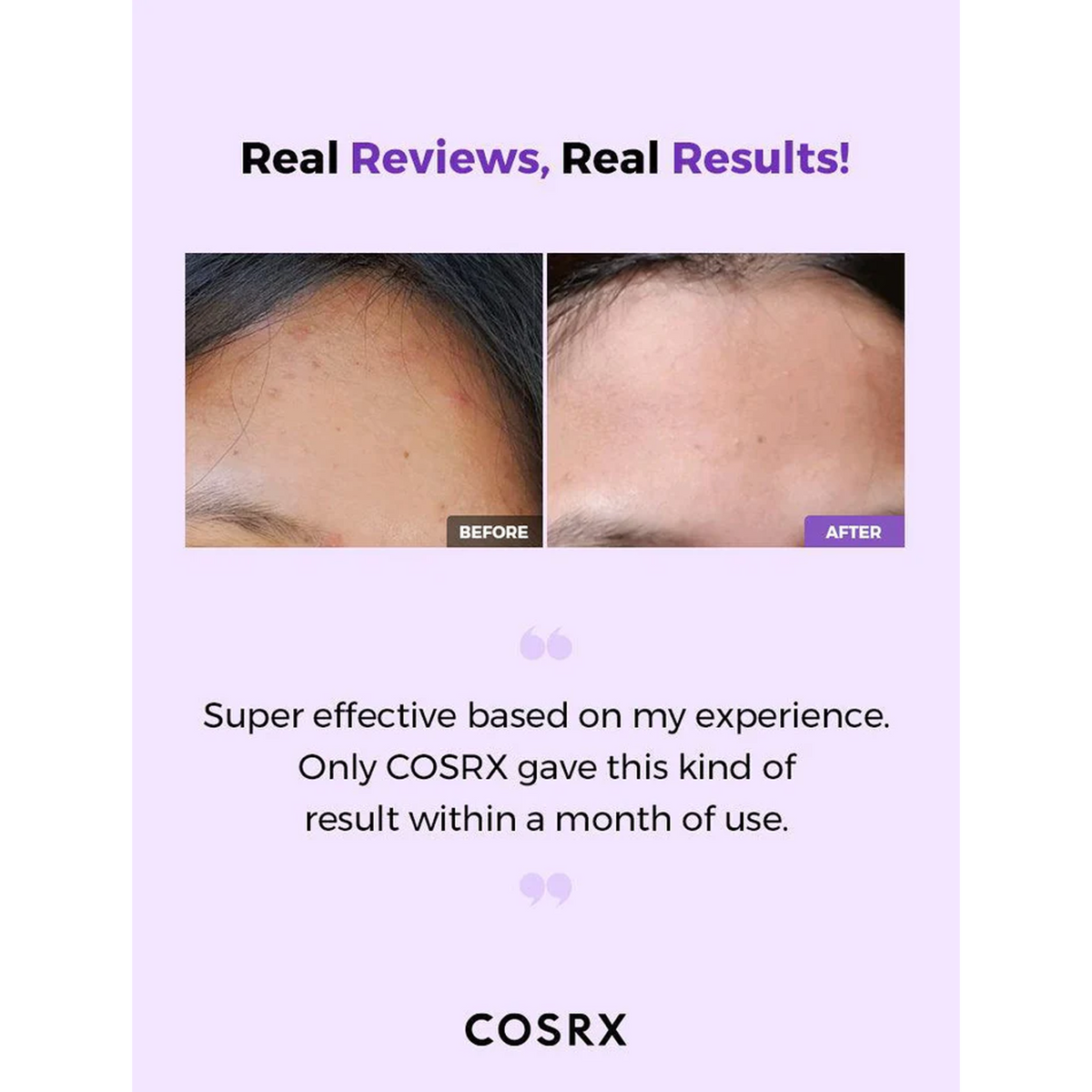 COSRX aha/bha Clarifying Treatment Toner - Real Reviews, Real Results 