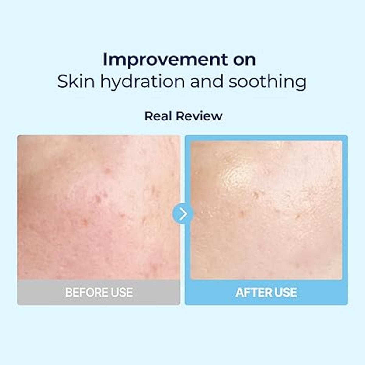 Torriden dive-in Low Molecular Hyaluronic Acid Multi Pad